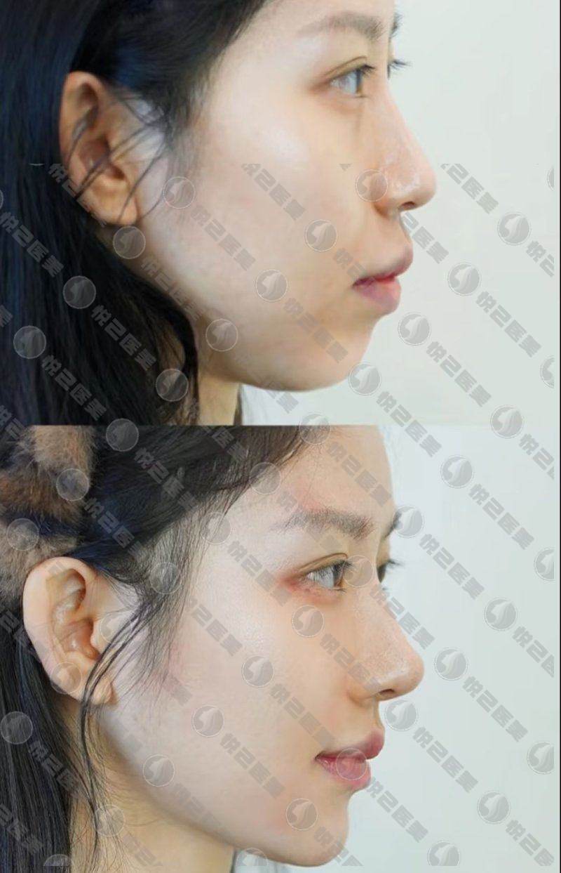 三、孝感华美整形美容医院地址在哪里？www.dgahi.com/
